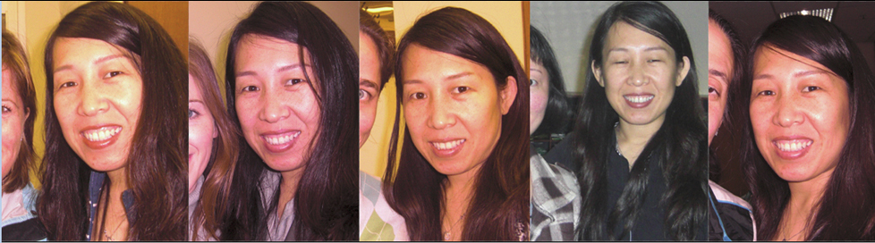 Patient collage used for fertility and FSH support information.